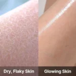 ژل شستشوی بدن ضد جوش مدیکیوب مدل 400ml RED ACNE - تصویر 4