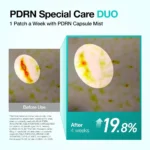 پک ۴ عددی پچ کلاژن و PDRN ذوب شونده آنوا برای خطوط خنده و گونه - تصویر 7